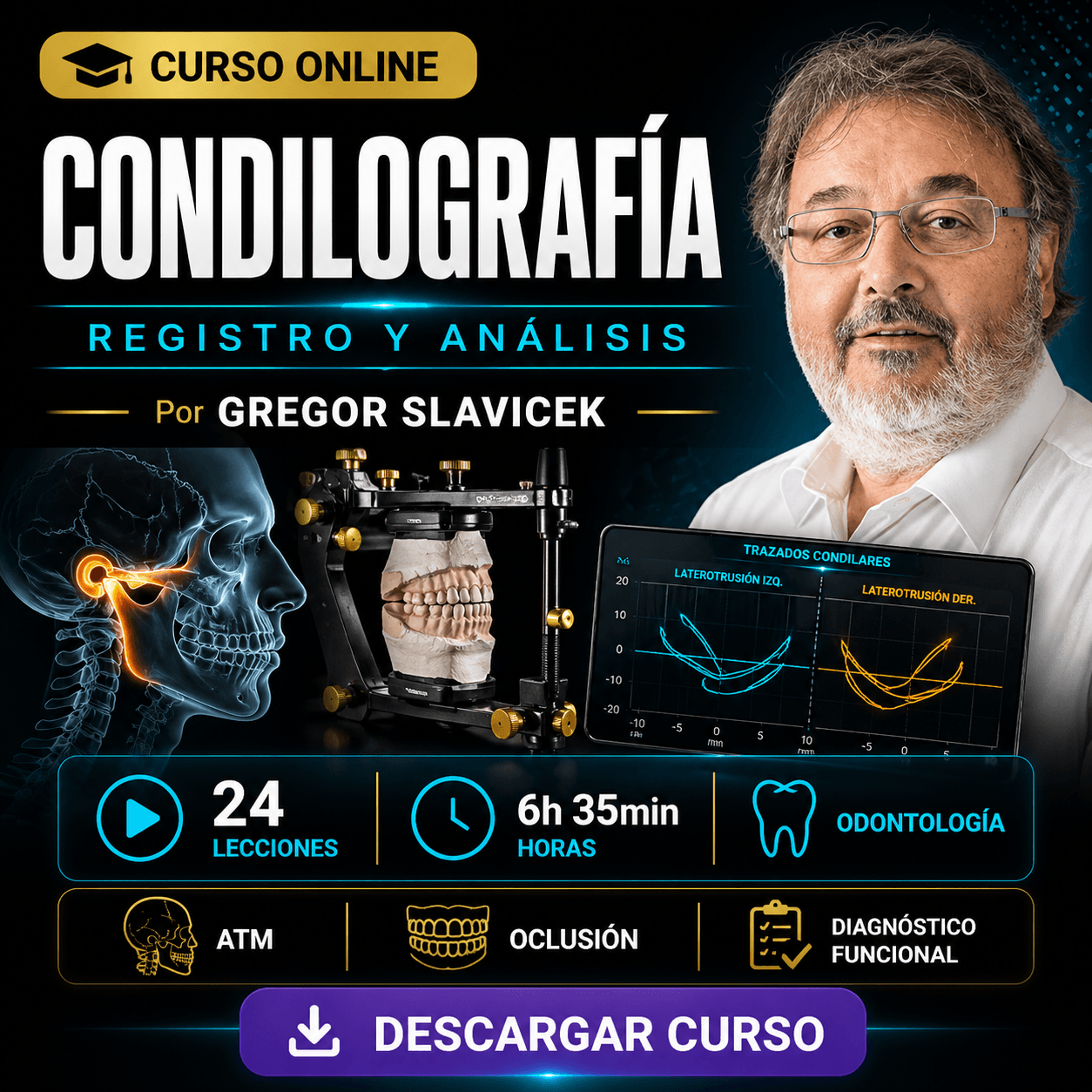 Condilografía: Registro y Análisis