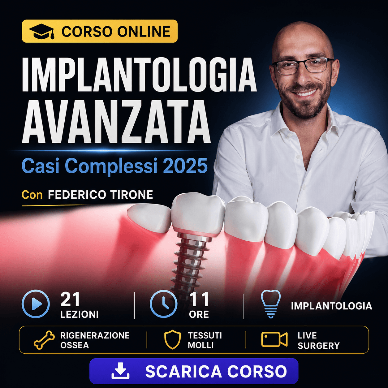 Implantologia Avanzata per il Trattamento dei Casi Complessi — Ottobre 2025