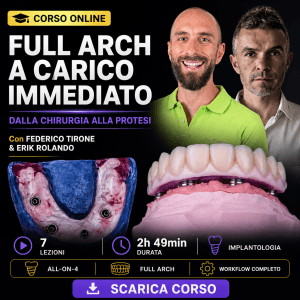 Riabilitazione Full Arch a Carico Immediato — Dalla Chirurgia alla Protesi