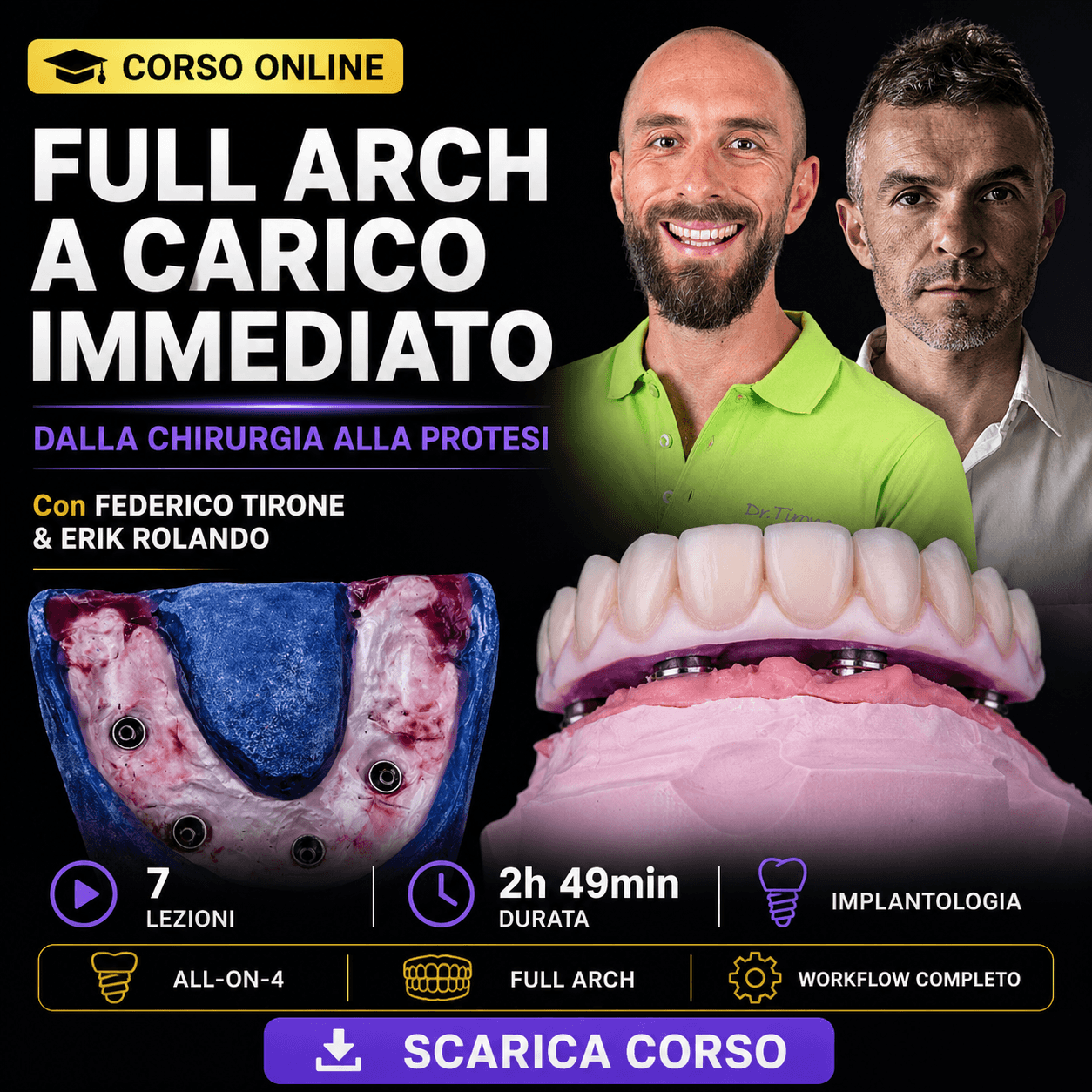Riabilitazione Full Arch a Carico Immediato — Dalla Chirurgia alla Protesi
