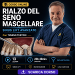 Rialzo del Seno Mascellare