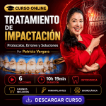 Tratamiento de Impactación: Protocolos, Errores y Soluciones