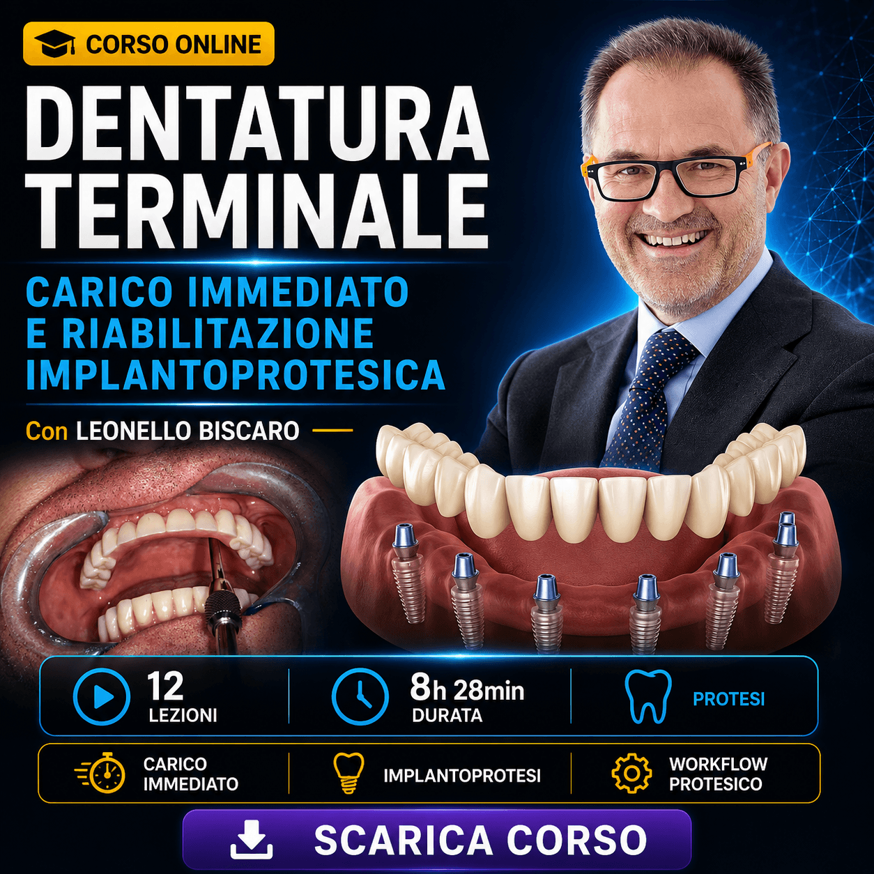 Dentatura Terminale: Guida alla transizione verso la protesi a supporto implantare